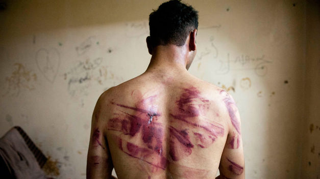 Victima-torturas-Siria_TINIMA20120825_0249_18